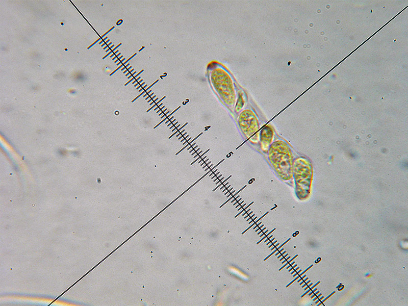 Heterosphaeria patella